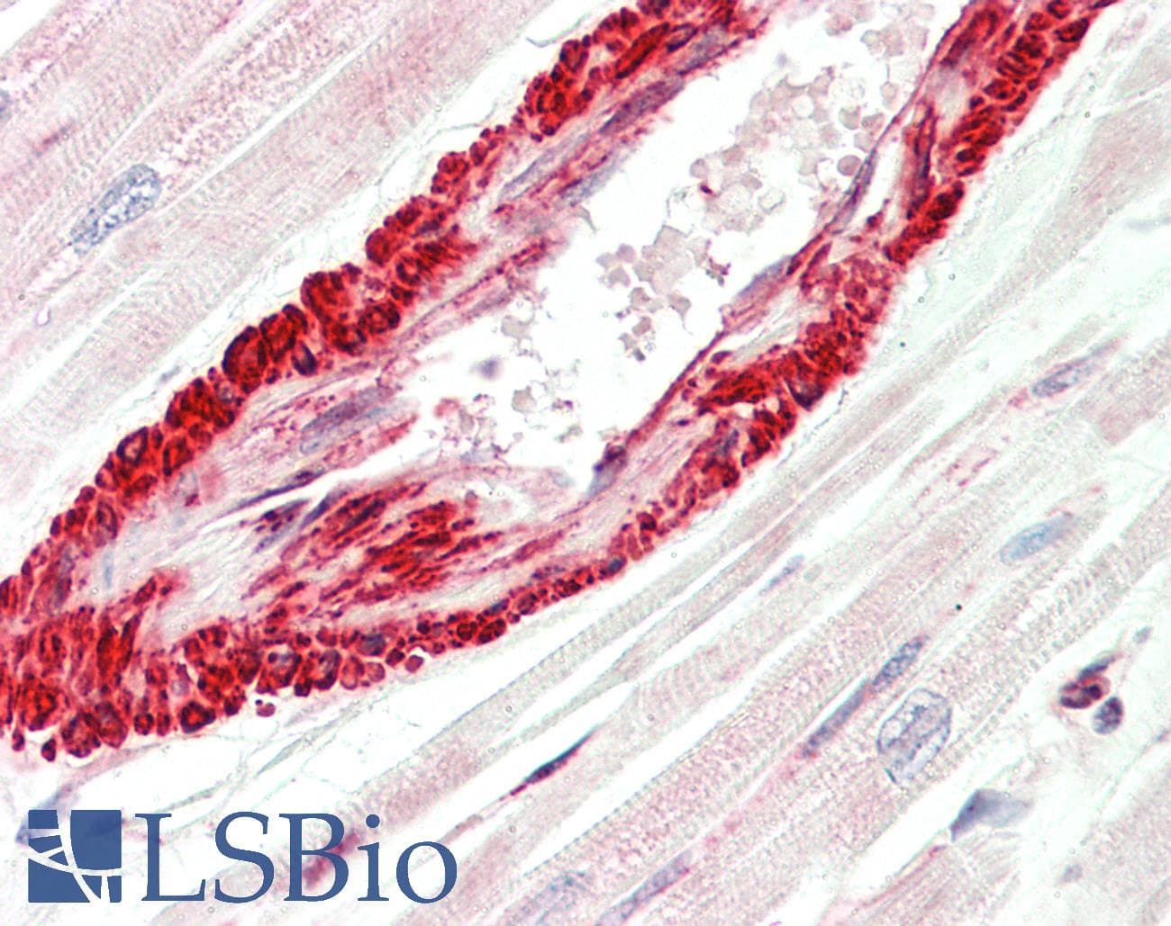 IHC-plus™ Polyclonal Rabbit anti-Human HSP90AA1 / Hsp90 Alpha A1 Antibody (K294, IHC, WB)