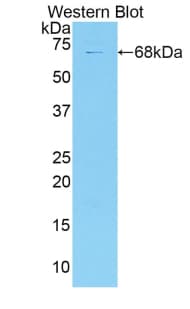 Endostatin Antibody (aa1072-1271)