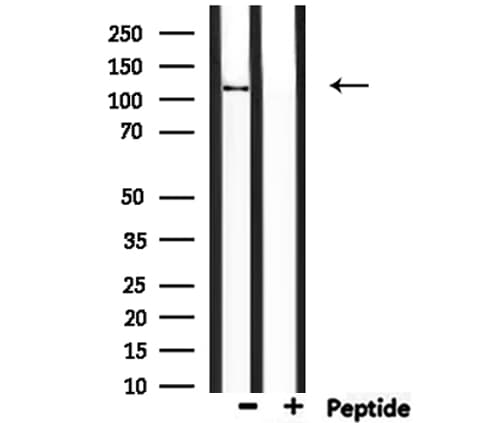 Polyclonal Rabbit anti-Human CCP110 Antibody (IHC, IF, WB)