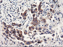PDSS2 / DLP1 Antibody (clone OTI1D12)