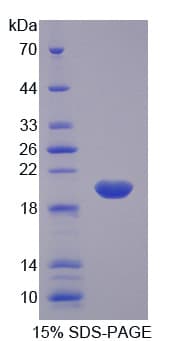 Human RARS Protein (Recombinant His)