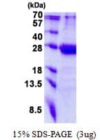 Human MED20 Protein (Recombinant His)