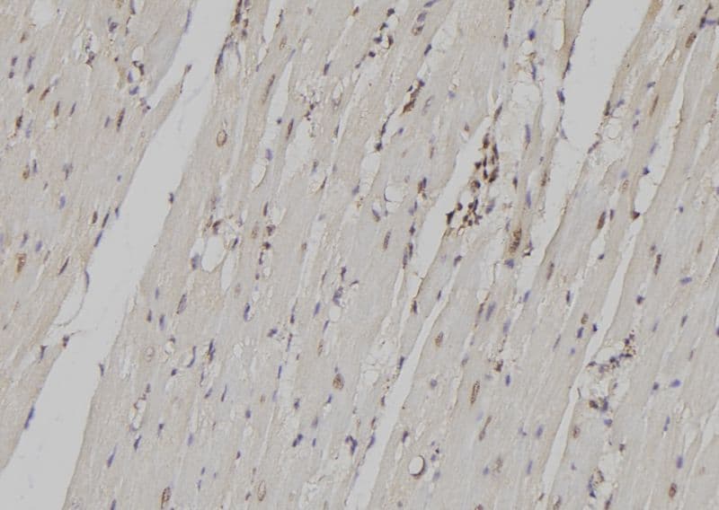 ZFC3H1 Antibody