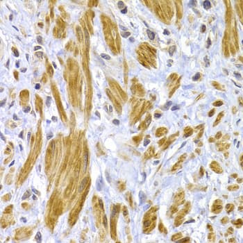 DSP / Desmoplakin Antibody