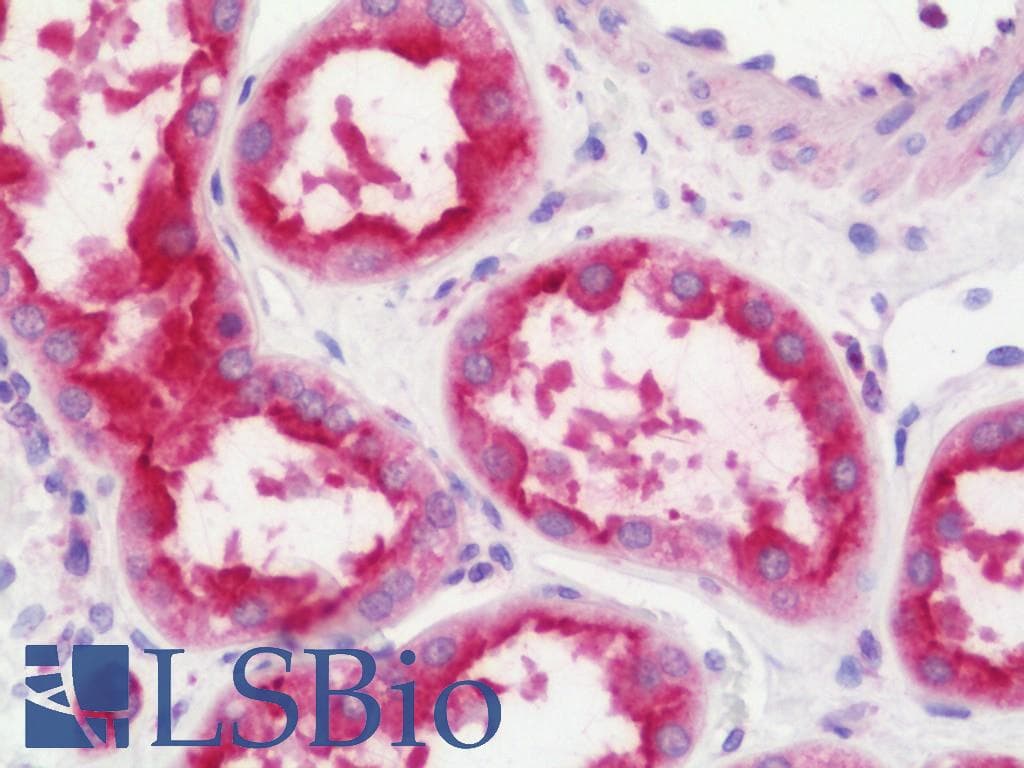 IHC-plus™ ADCK4 Antibody (aa141-460)