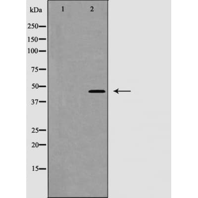 Polyclonal Rabbit anti-Human CASP1 / Caspase 1 Antibody (phospho-Ser376, IF, WB)