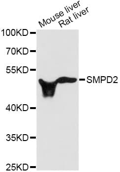 Polyclonal Rabbit anti-Human SMPD2 Antibody (IHC, WB)
