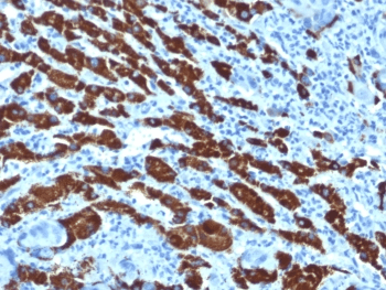Hepatocyte Specific Antigen Antibody (clone OCH1E5, Ready-to-Use)