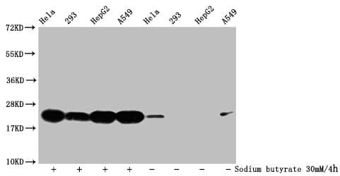 HIST1H1C Antibody