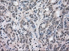 MAPK1 / ERK2 Antibody (clone OTI6E5)