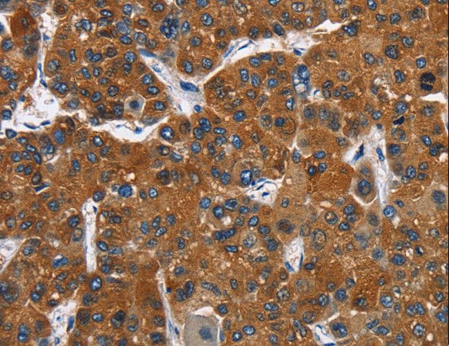 CATSPER3 Antibody