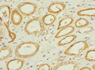 Polyclonal Rabbit anti-Human TPK1 Antibody (IHC, IF, WB)