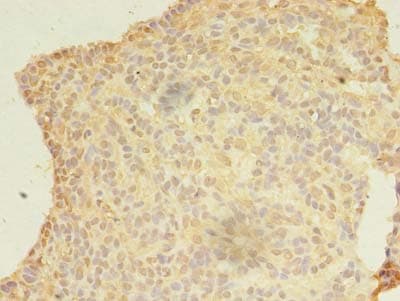 Polyclonal Rabbit anti-Human KIAA1257 Antibody (IHC)