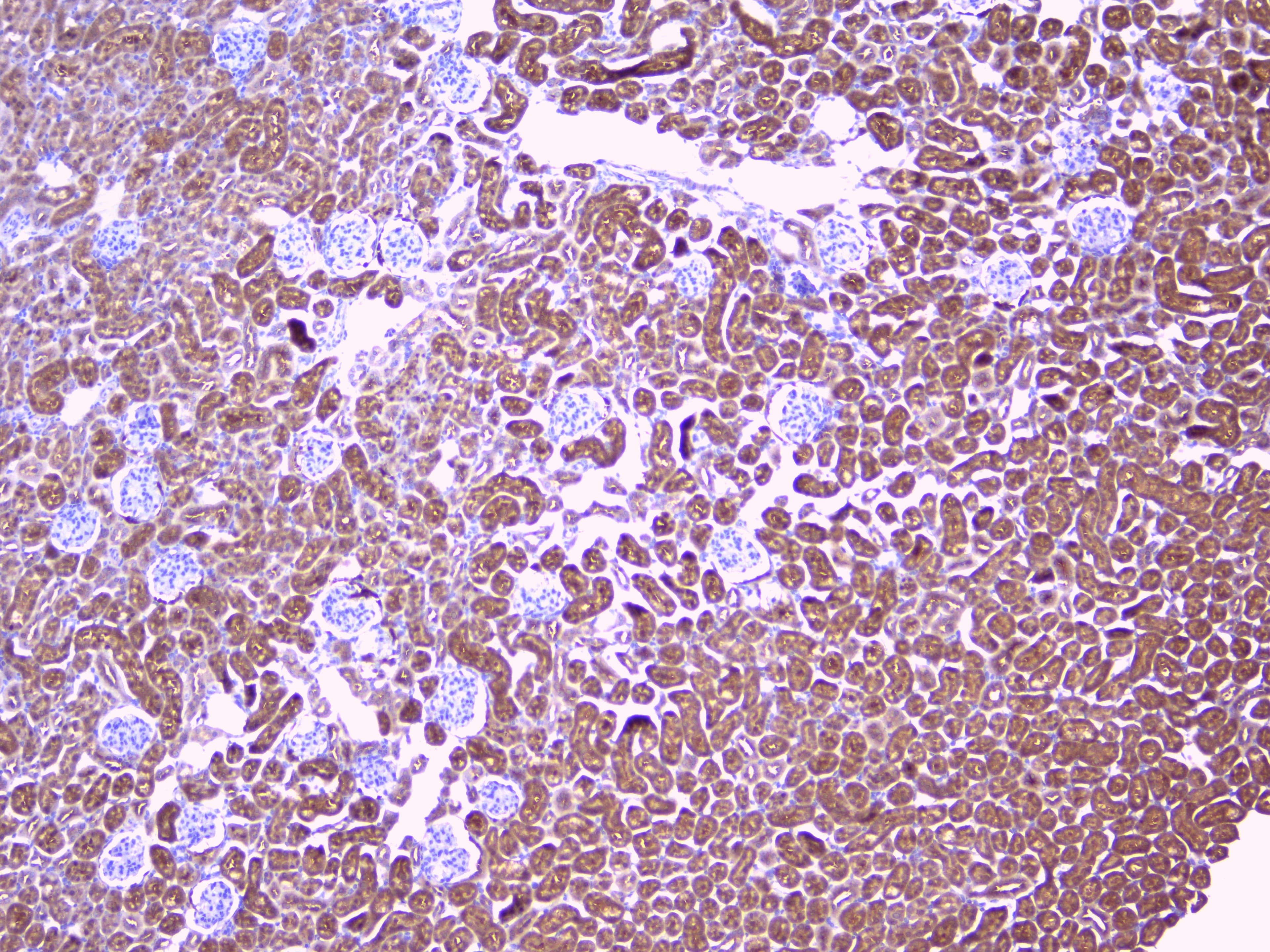 Polyclonal Rabbit anti-Human PEBP1 / RKIP Antibody (WB)