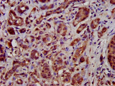 TFB1M Antibody