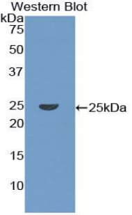 CORO1A / Coronin 1a Antibody (aa7-204)