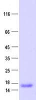 Human ETV3 Protein (Recombinant His, N-Terminal)