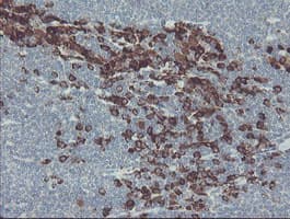 Monoclonal Mouse anti-Human GORAB / SCYL1BP1 Antibody (clone OTI1E3, aa35-394, IHC, WB)
