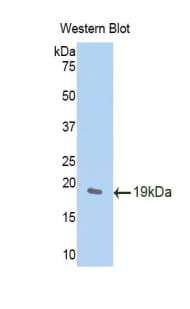 CCN4 / WISP1 Antibody (aa213-350, Biotin)