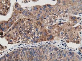 OSBP Antibody (clone OTI1F2)