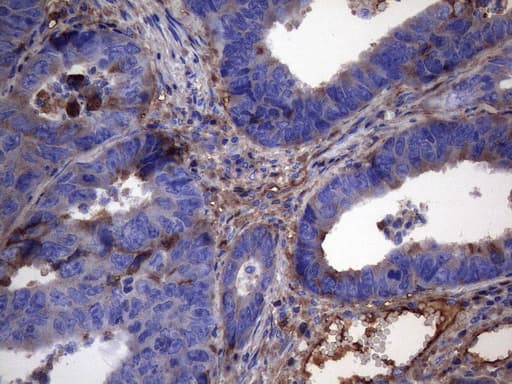 CRP / C-Reactive Protein Antibody (clone OTI7C3)