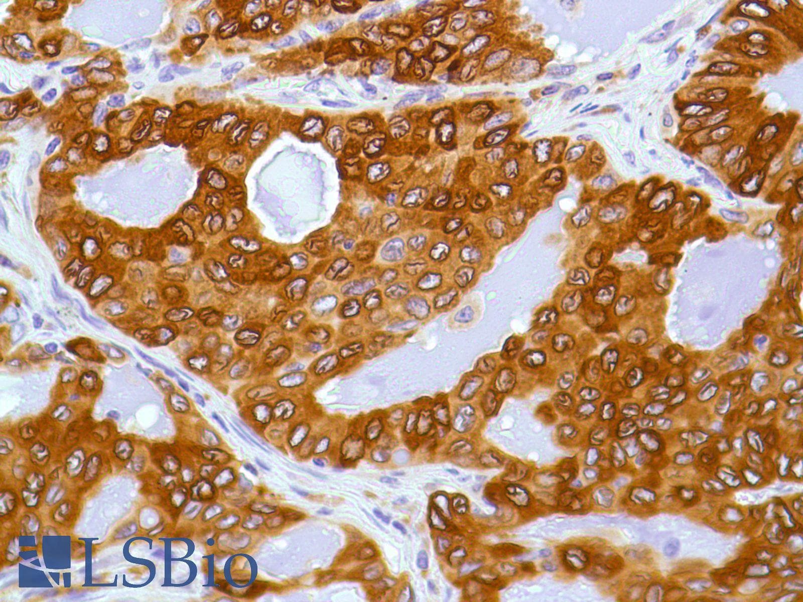 PTGS2 / COX2 / COX-2 Antibody (C-Terminus, clone SP21)