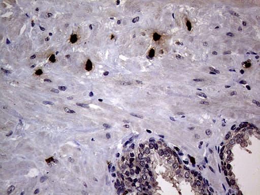 PRTN3 / Myeloblastin Antibody (aa28-248, clone OTI9C2)