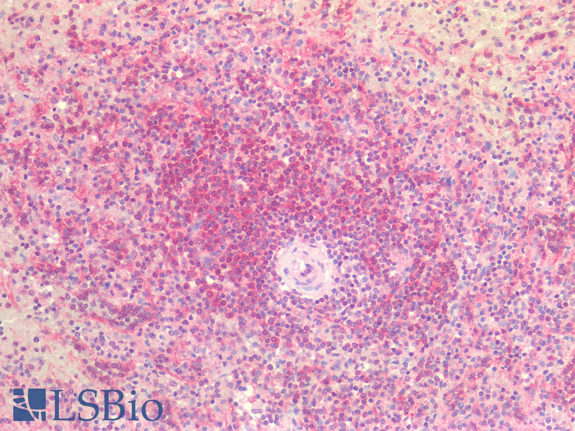 IHC-plus™ Polyclonal Rabbit anti-Human IL25 / IL17E Antibody (IHC)