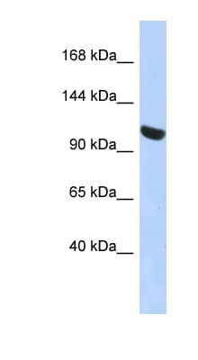 Polyclonal Rabbit anti-Human UBA1 / UBE1 Antibody (N-Terminus, WB)