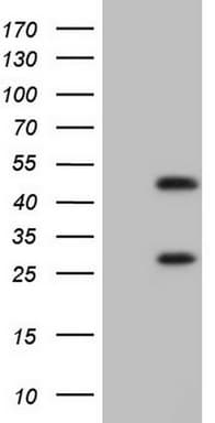 Monoclonal Mouse anti-Human NR1I3 / CAR Antibody (clone OTI1B2, Carrier-free, aa1-236, IHC, WB)