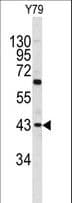 Polyclonal Rabbit anti-Human PRELP / Prolargin Antibody (aa257-286, IHC, WB)