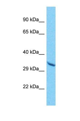 OR10A6 Antibody (aa216-265)