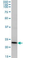 Recoverin Antibody (clone 3F6)