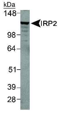 IREB2 / IRP2 Antibody (Internal, Biotin)