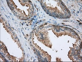 ALDH3A1 Antibody (clone 1B6, Carrier-free)