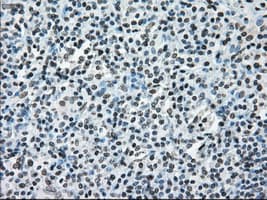 ERCC1 Antibody (clone OTI1A3)