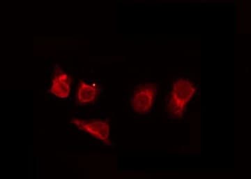 OR89 Antibody