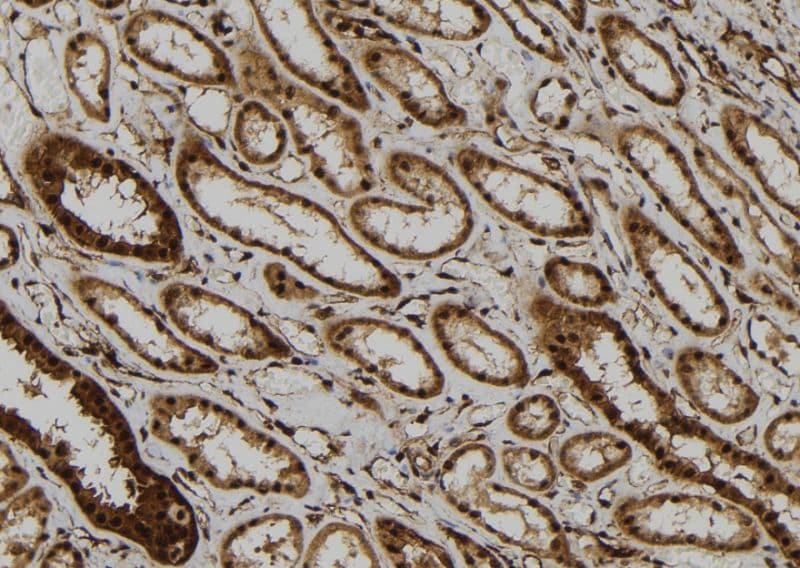 PP2CB / PPP2CB Antibody