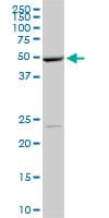 POLE2 Antibody (clone 1A3)
