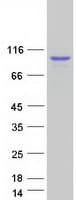 Human DDX1 Protein (Recombinant Myc-DDK (Flag))