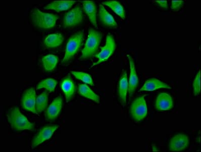 LMCD1 Antibody