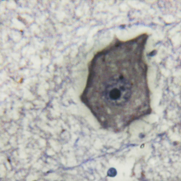 IL6ST / CD130 / gp130 Antibody