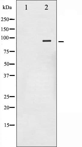 NR3C1/Glucocorticoid Receptor Antibody (phospho-Ser211)