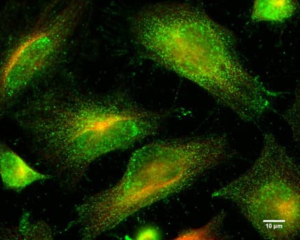 ULK1 Antibody (aa400-499)