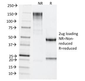 TDP2 / TTRAP Antibody (clone TDP2/1258)