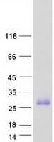 Human TMEM52 Protein (Recombinant Myc-DDK (Flag))
