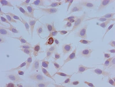 HIST1H3A Antibody (phospho-Ser10)