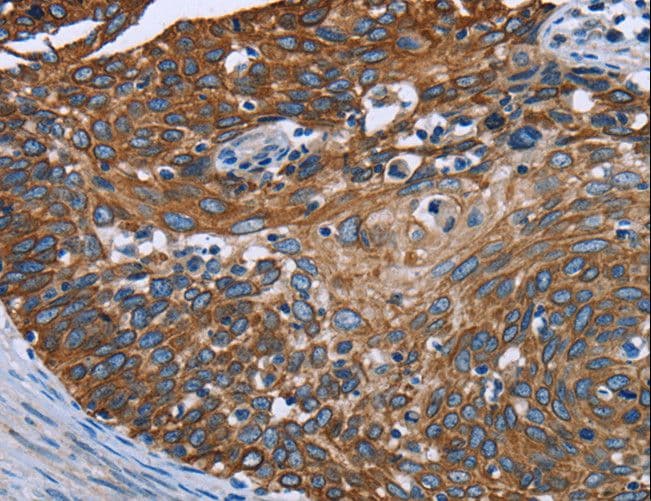 Polyclonal Rabbit anti-Human FCGR3A / CD16A Antibody (IHC)