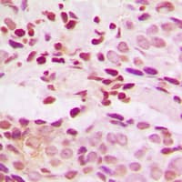 JUNB / JUN-B Antibody (C-Terminus)