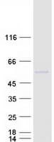 Human PLAU / Urokinase / uPA Protein (Recombinant Myc-DDK (Flag))
